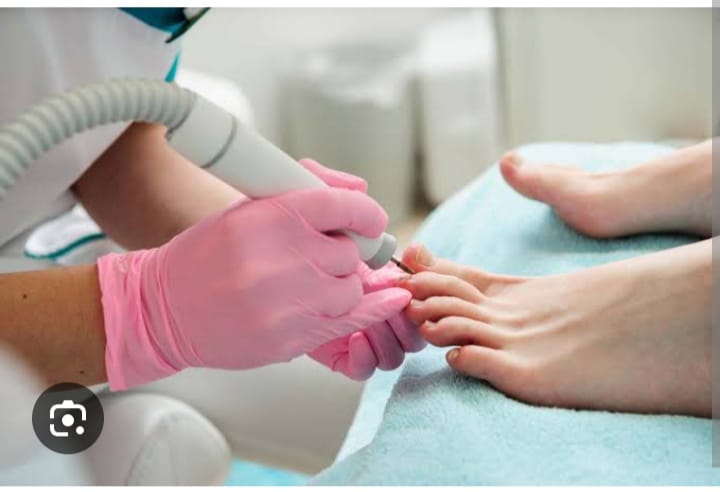 Nail Surgery Treatment with best dermatologist i.e. Dr. Meghana Rane at Andheri West Mumbai