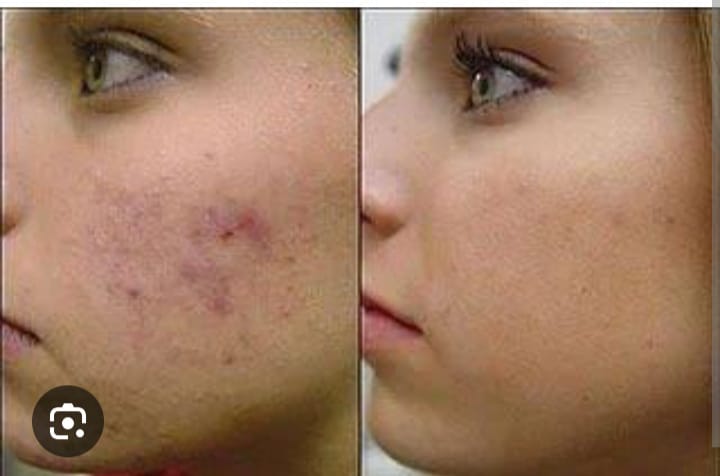 skin treatment services with best dermatologist in andheri mumbai